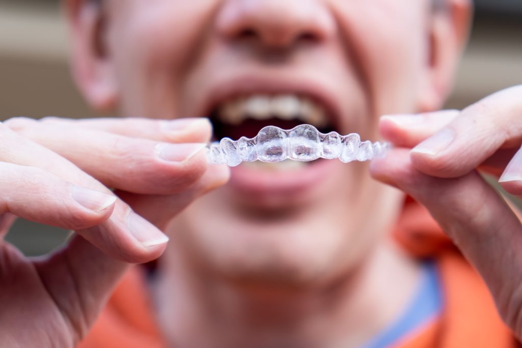 man holds and put on Invisalign invisible, clear braces