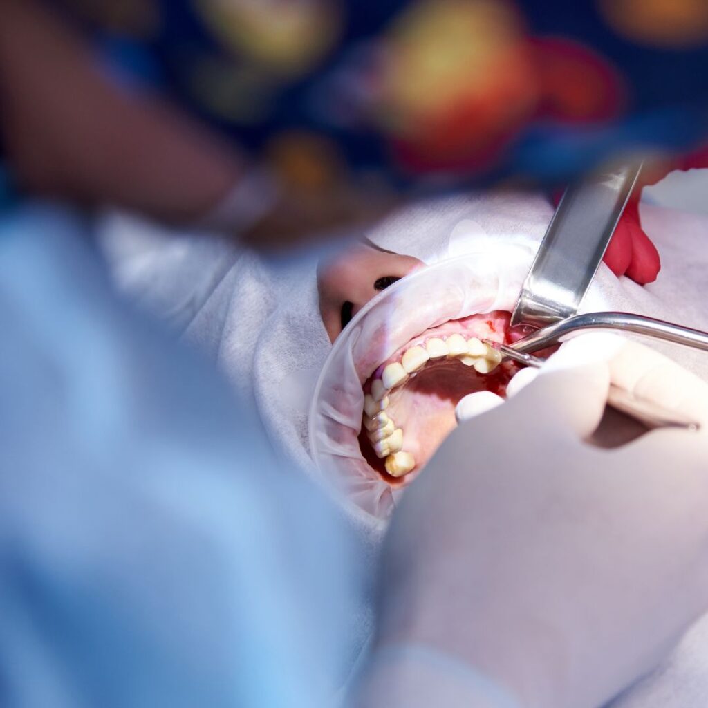 Bone grafting surgery