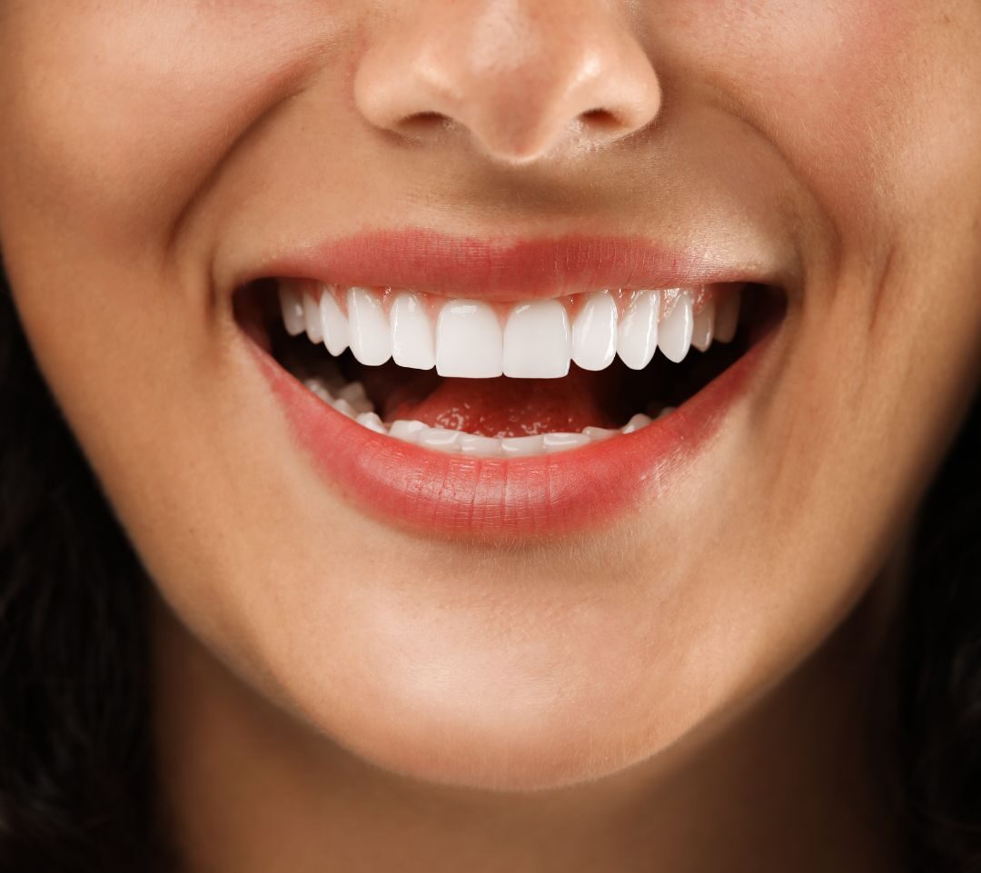 contoured gum line