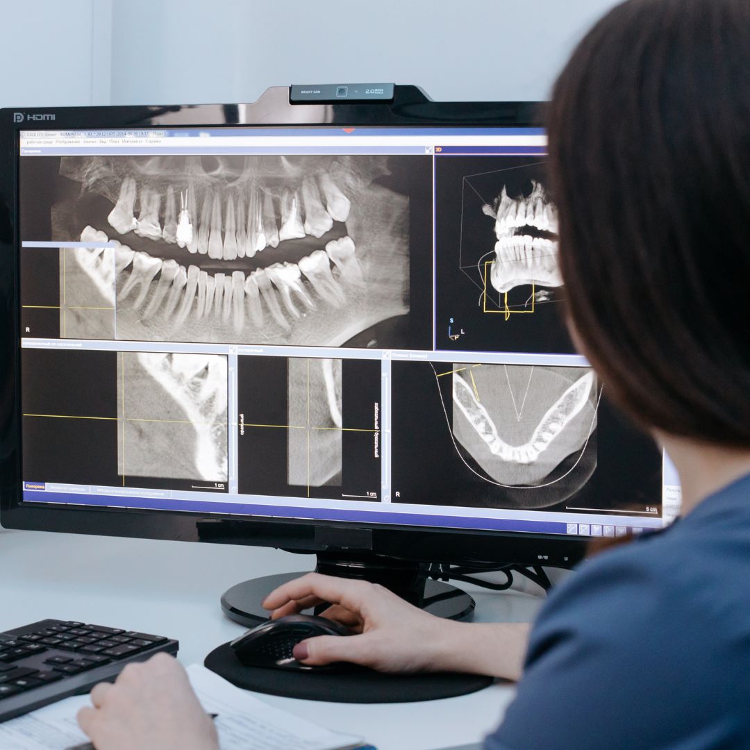 checking dental x ray