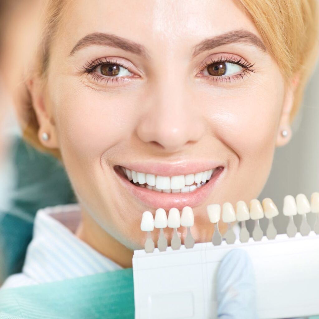 dental bonding teeth matching