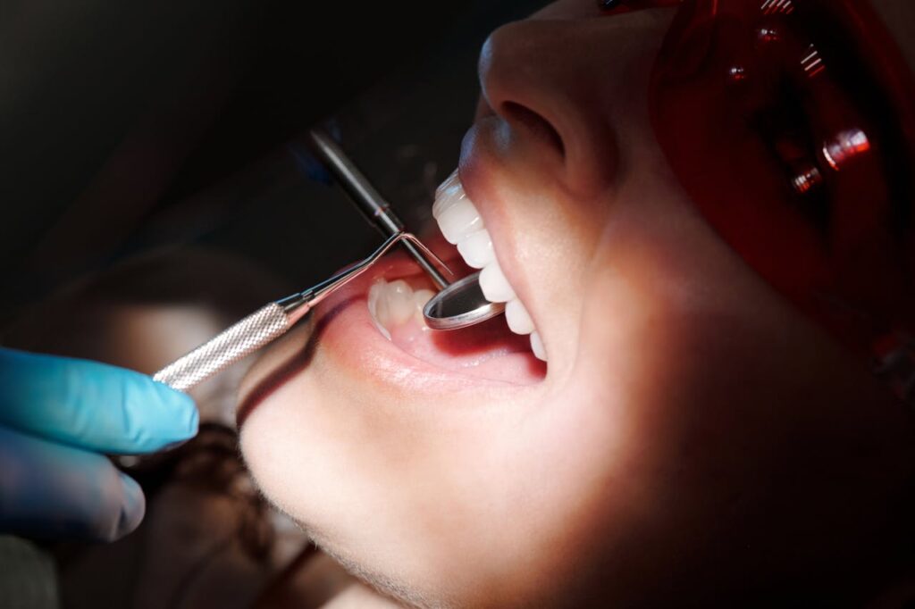 Teeth Whitening and Sensitive Teeth